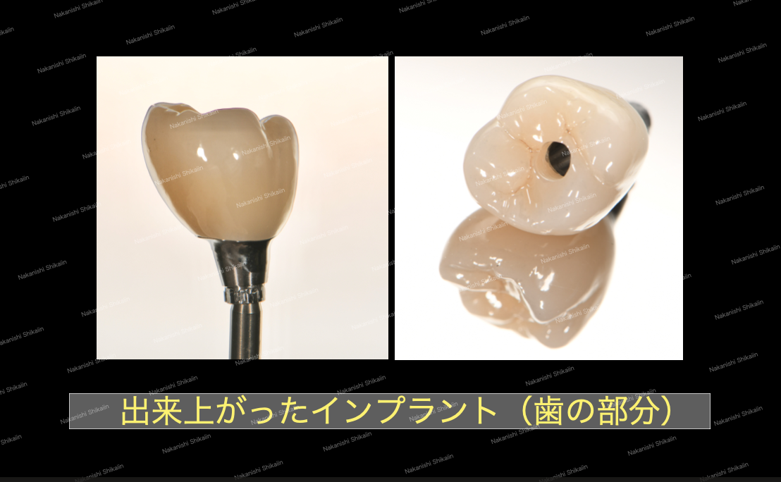 ブログ｜津市久居の歯医者｜ナカニシ歯科医院